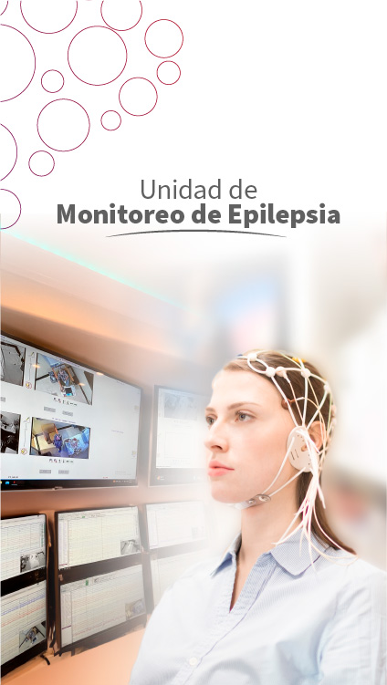 Unidad de Monitoreo de Epilepsia